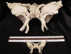 Sphenoid - Quadruple Size