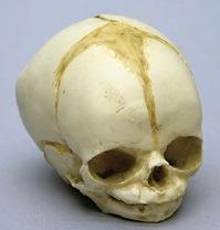 Osteo Cast Fetal Skull - 32 weeks  BC-181