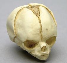 Osteo Cast Fetal Skull - 20 weeks BC-194