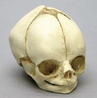 Osteo Cast Fetal Skull - 29 weeks BC-195