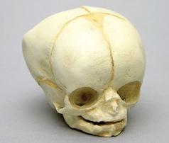 Osteo Cast Fetal Skull - 35 weeks old - BC-227