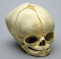 Osteo Cast Fetal Skull - Full Term 40 1/2 Weeks BC-228