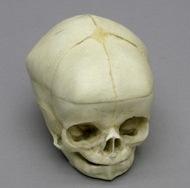 Osteo Cast Fetal Skull 40 weeks BC-281 W/ Calvarium Cut